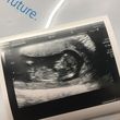 Baby Orla Strachan Hainey