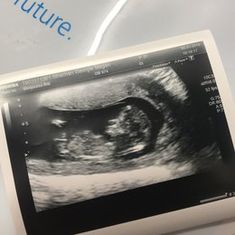 Baby Orla Strachan Hainey