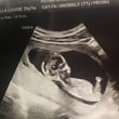 Baby Isabella Pountney
